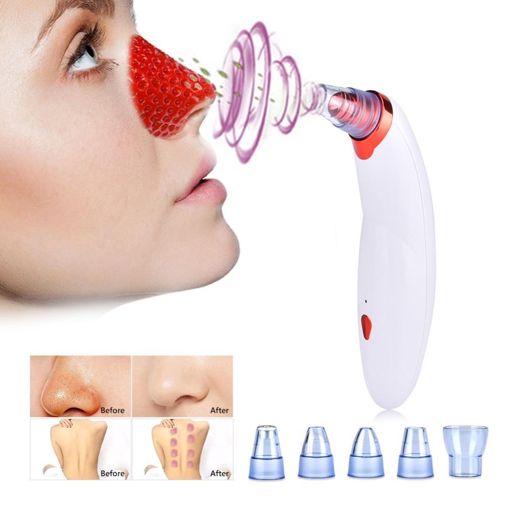 BetterSkin™️ - The Facial Extraction Vacuum