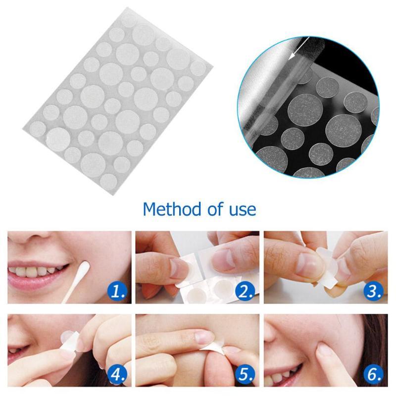 ClearSkin™️ - The 36pcs/Set Acne & Blackhead Patch